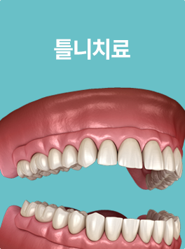 틀니치료